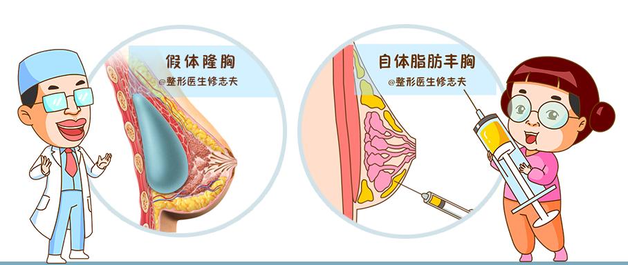 最新款隆胸假体，美丽旅程中的内心平静探寻